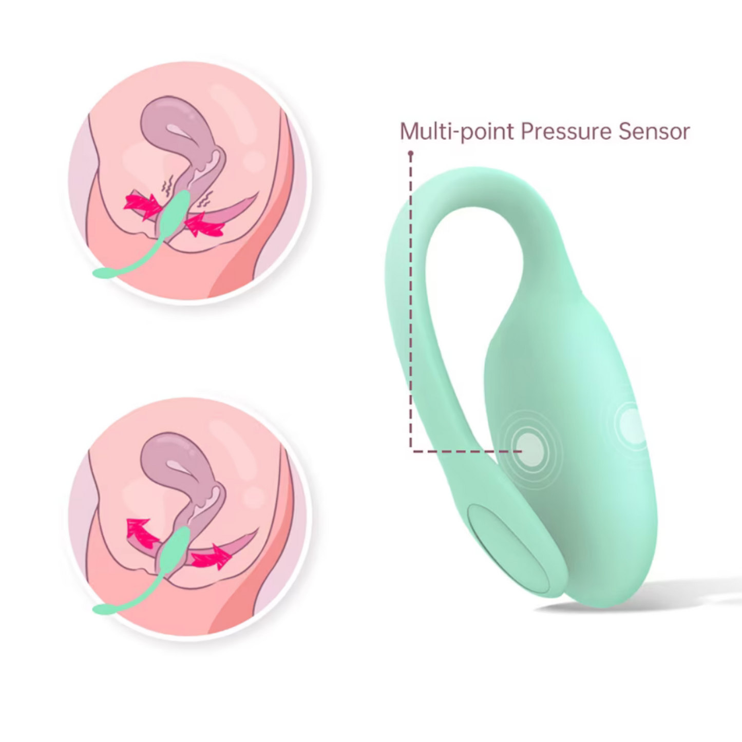 Fitcute Kegel Rejuve - Rééducateur périnéal connecté